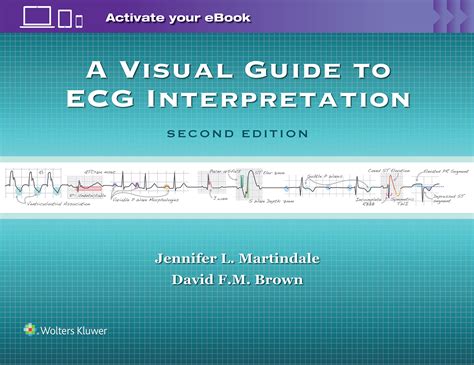 A visual guide to ecg interpretation. - A visual guide to ecg interpretation.